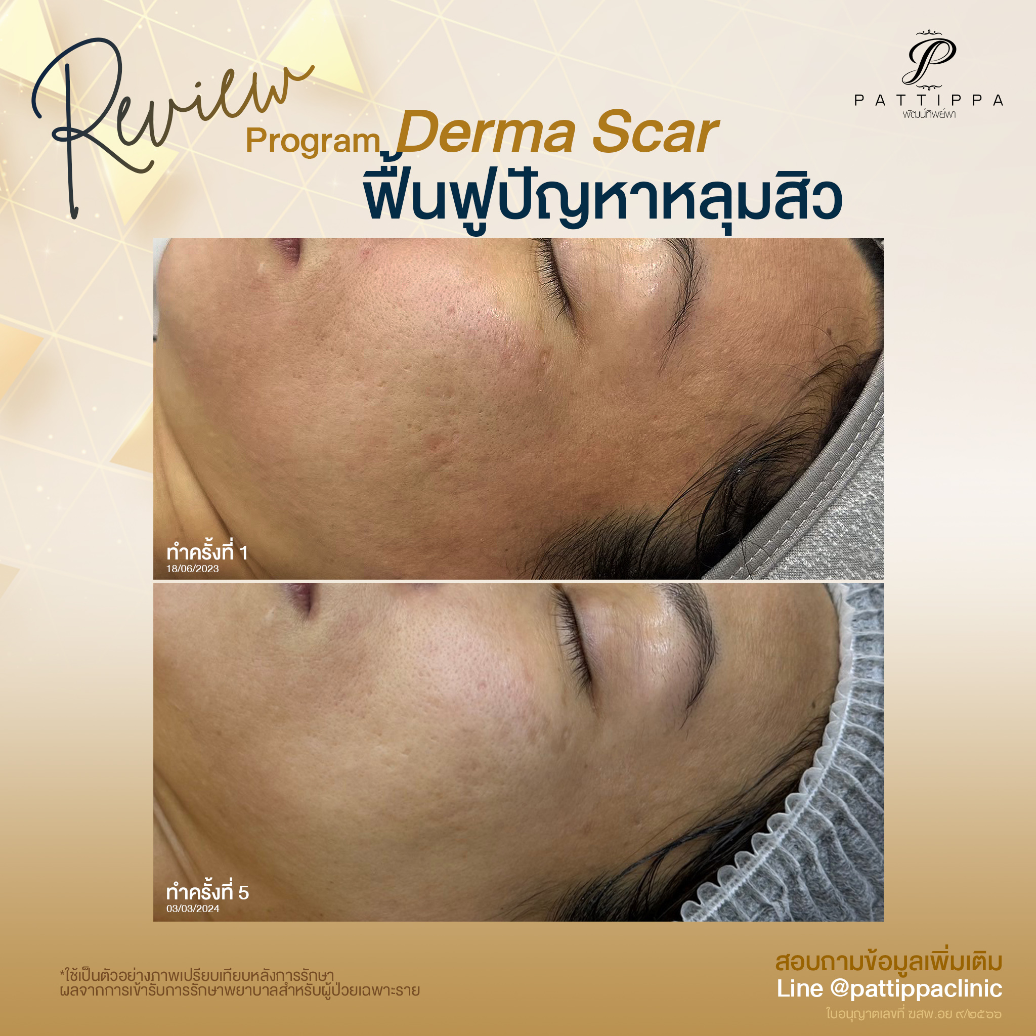 Patt_review_derma-scar_001