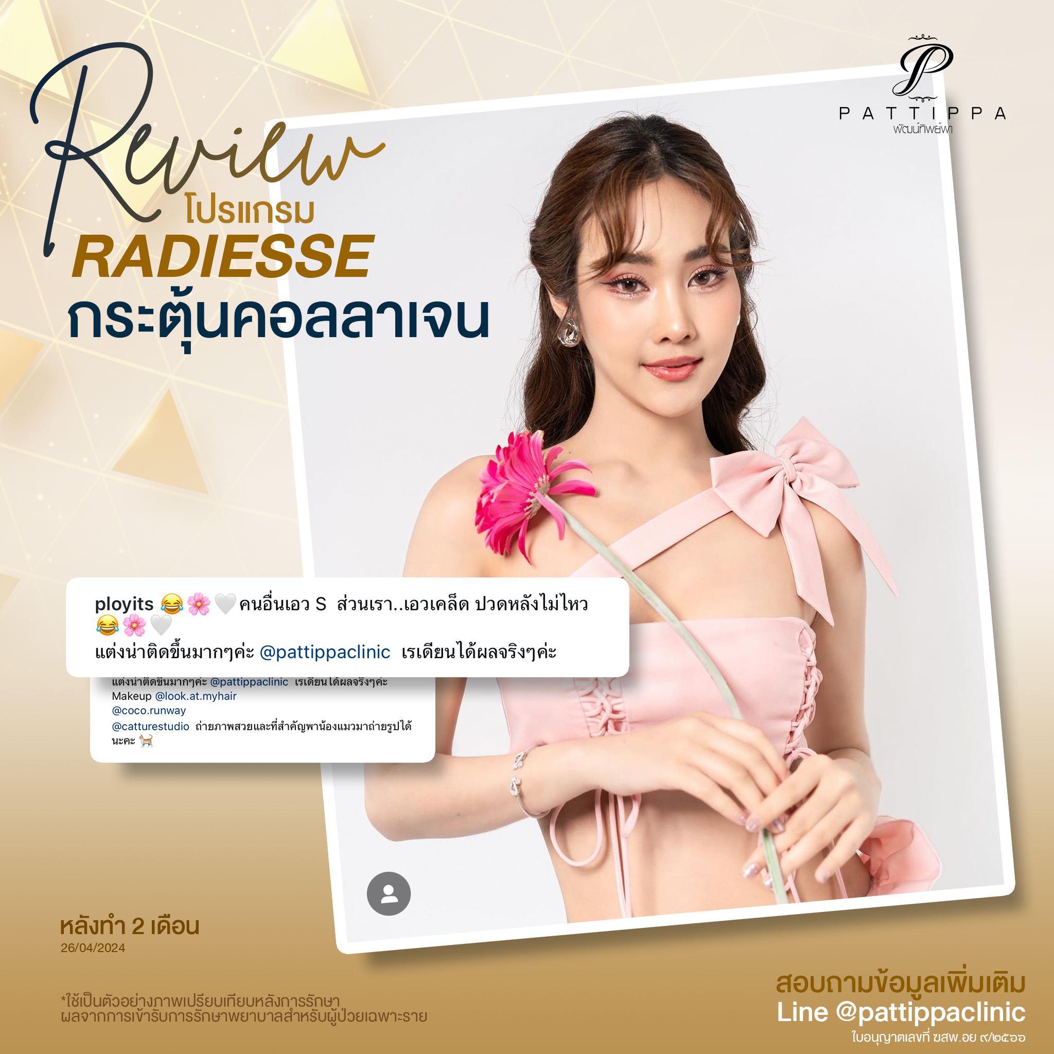 Patt_review_radiesse_003