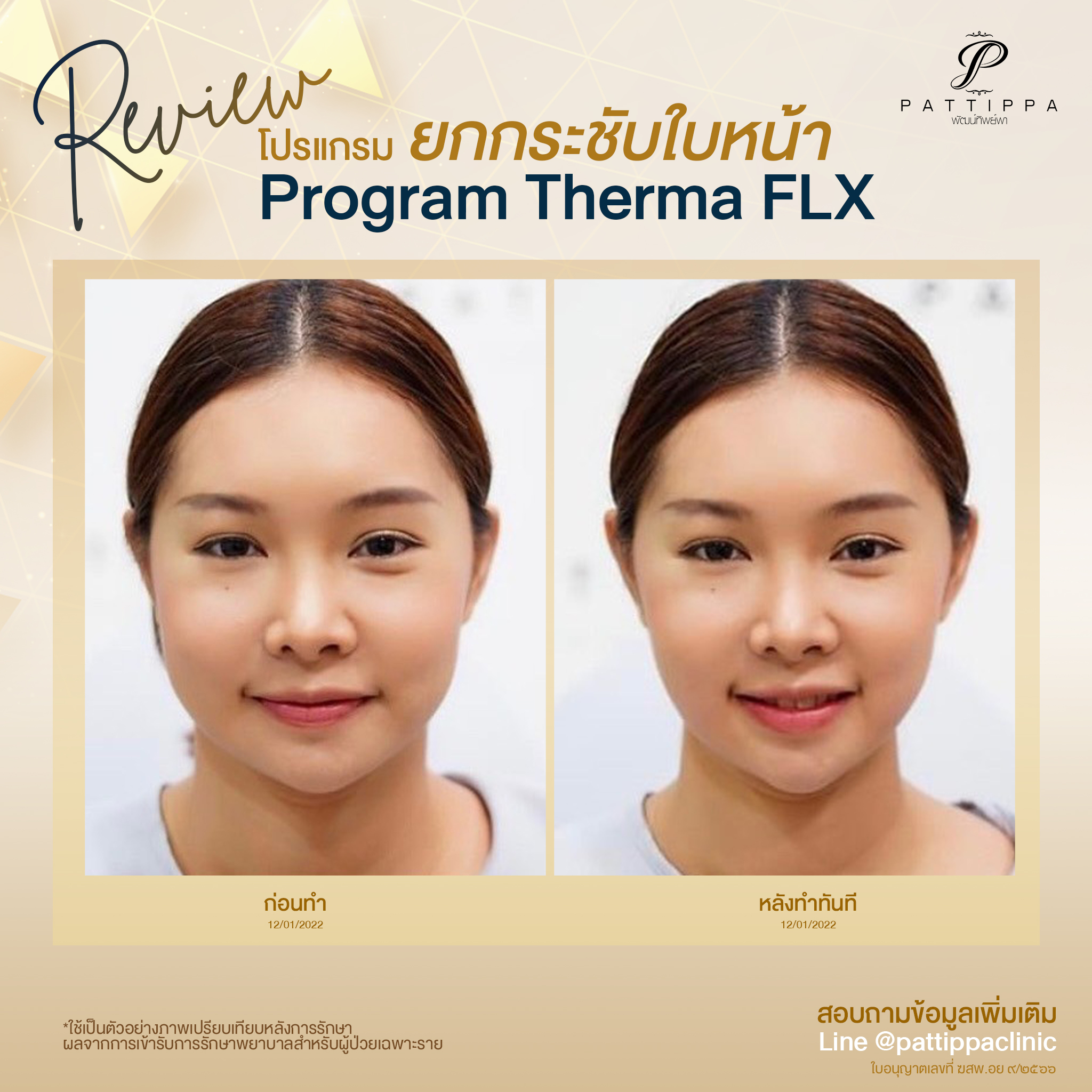 รีวิว โปรแกรม Thermal FLX