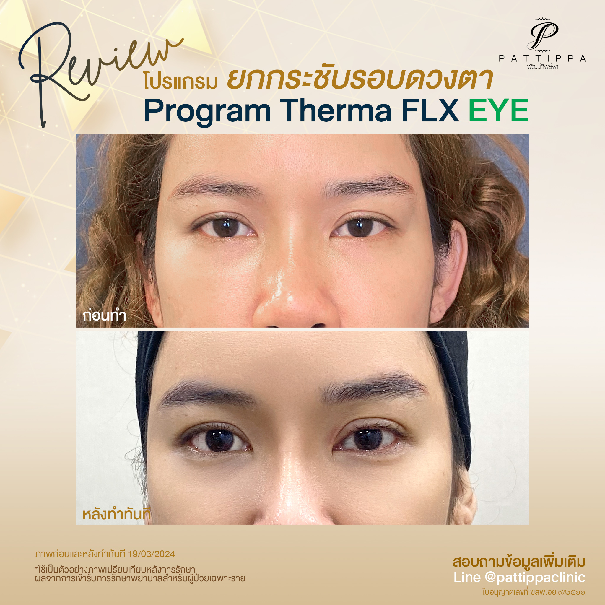 รีวิว โปรแกรม Thermal Eye