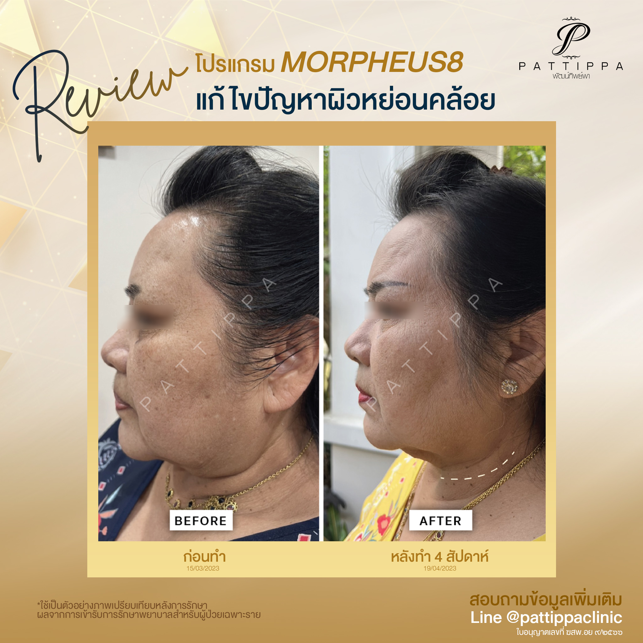 รีวิว โปรแกรม MORPHEUS