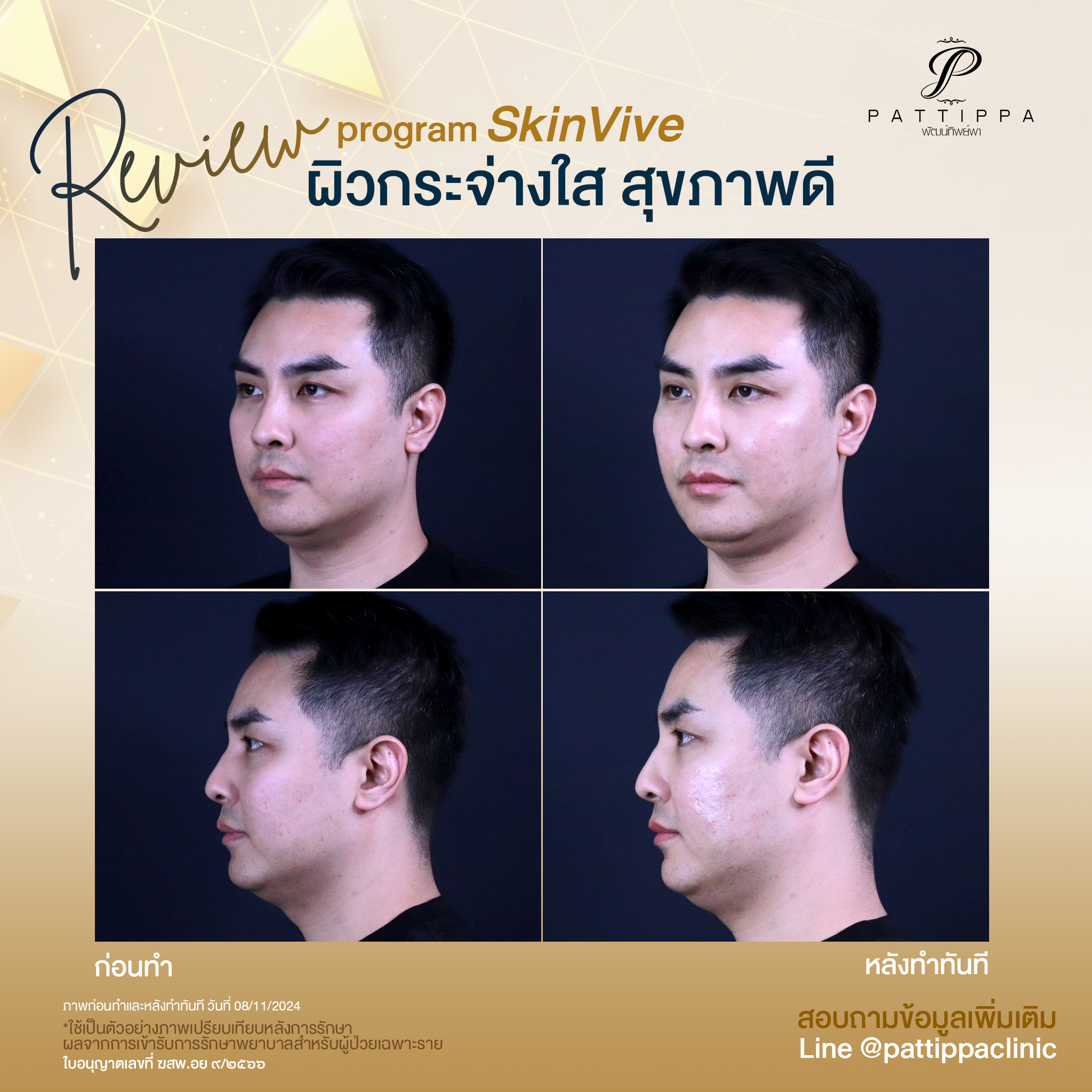 Patt_review_skinvive_001-1