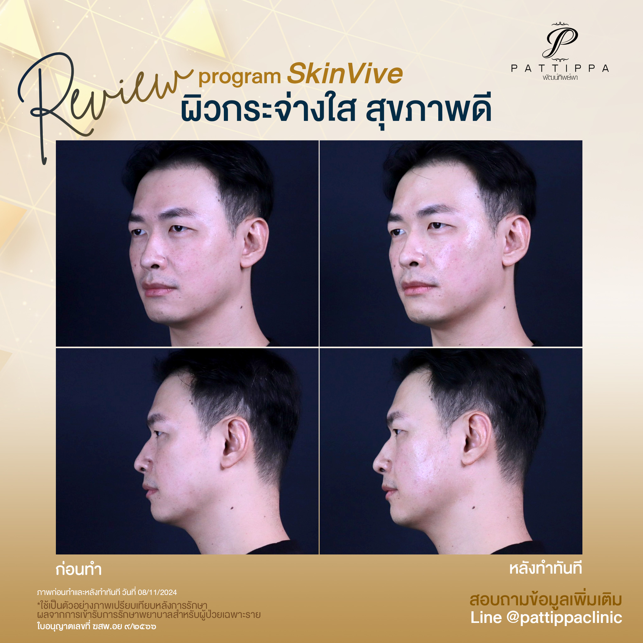 Patt_review_skinvive_002-1