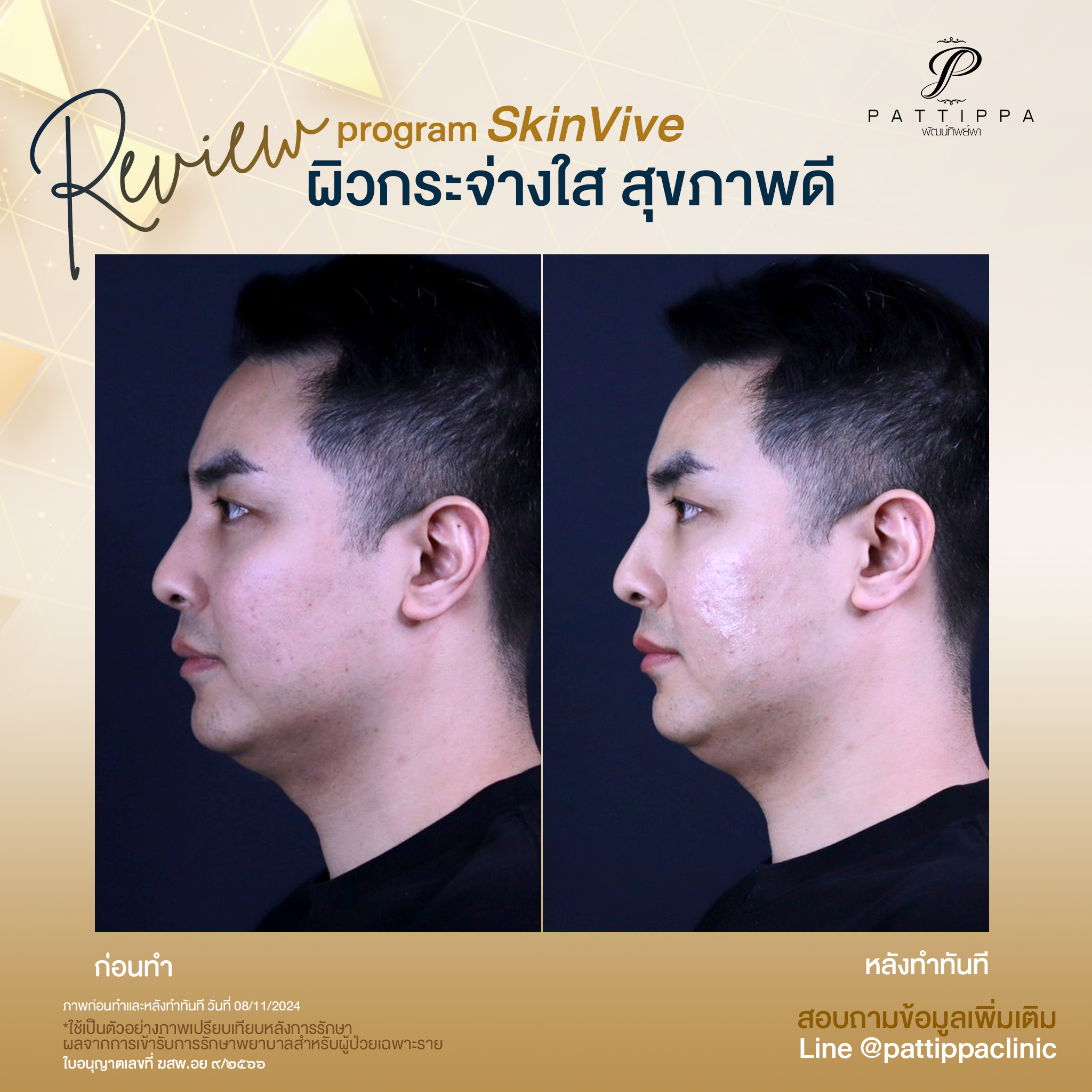 Patt_review_skinvive_003-2