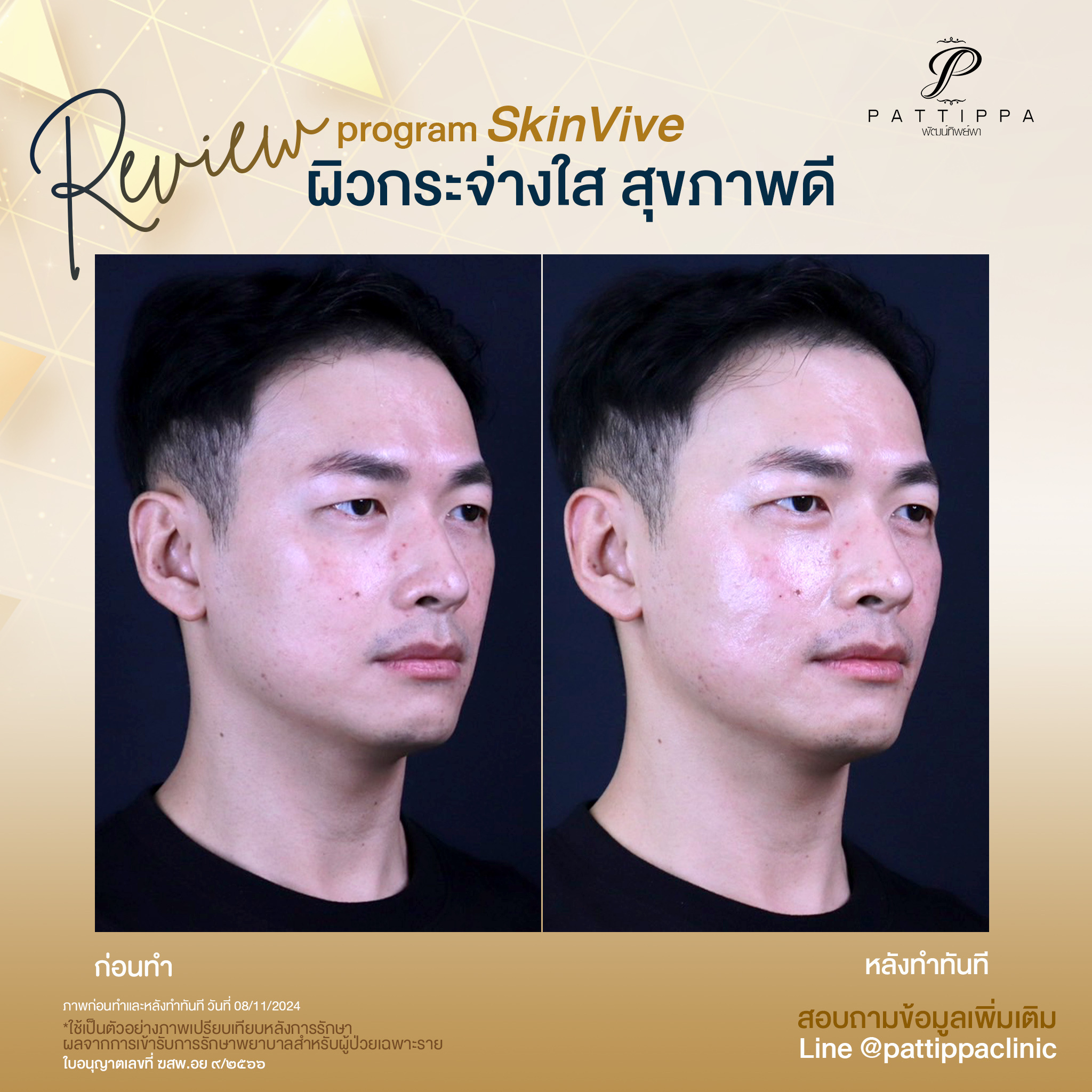 Patt_review_skinvive_004-1