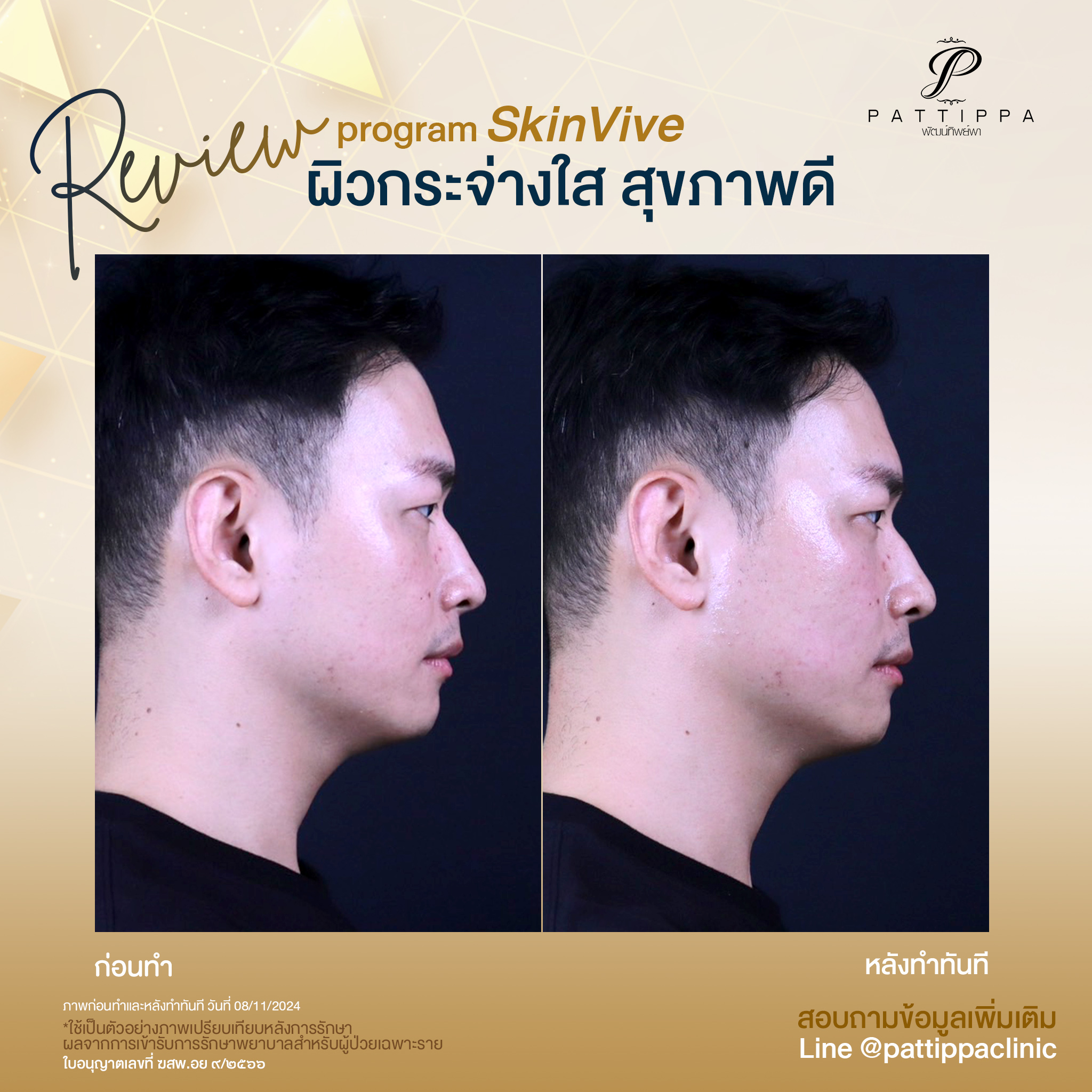 Patt_review_skinvive_004-2