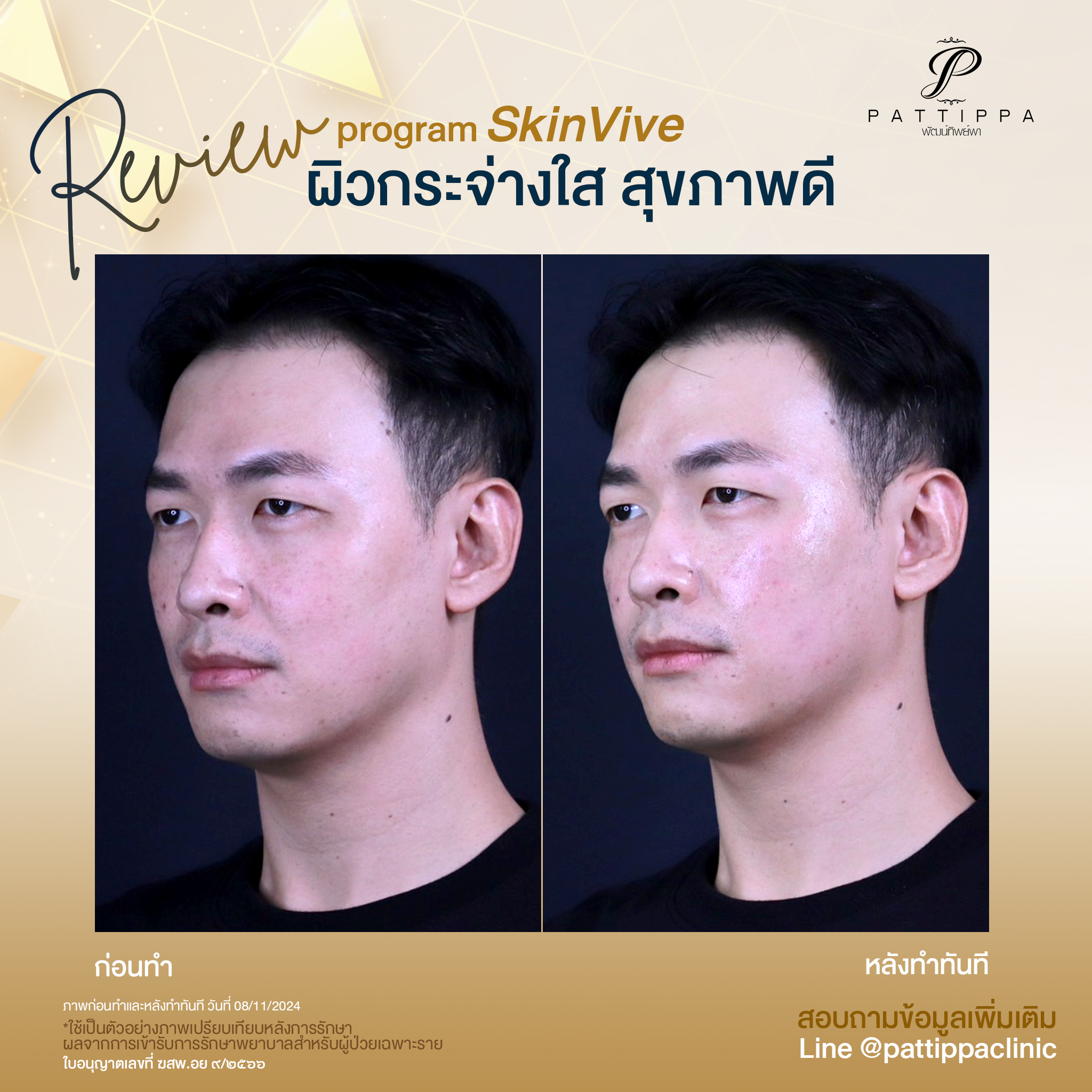 Patt_review_skinvive_004-3